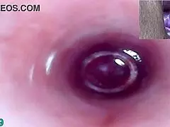 lesbians dive into extreme cervix play with peehole dildo action