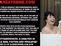 Dirtygardengirl & Analyen In Double Anal Fisting And Prolapse!