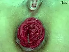 destroyed anal juicy prolapse asshole close up play with milf amateurs