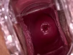 Oh wow, Mia Austin with a speculum, it's so detailed and close up, lucky me!