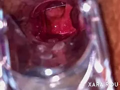 Anal vision speculum reveals hairy mature bbw's gaping asshole