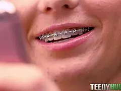 yo eli luxx rocks those blinding braces while riding daddy in hardcore pov doggystyle... beautiful teen braces action!